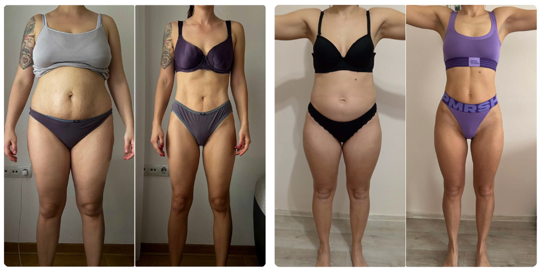 nikola orozovic dijastaza